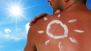 Stay precautious this summer with these Sunburn care tips and remedies
